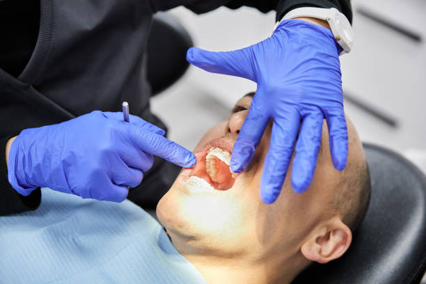 Best Dental Abscess Treatment in Lawrenceburg, TN